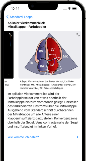 echopilot auf dem iPhone: apikaler Vierkammerblick mit Farbdoppler