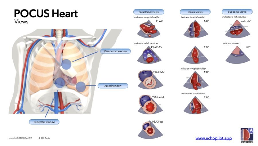 Vorschau: POCUS Heart – Views